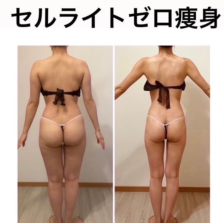 ミラクル美骨コルギ